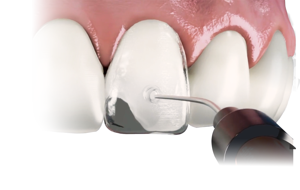 SEO Manager - Premier Dental Products